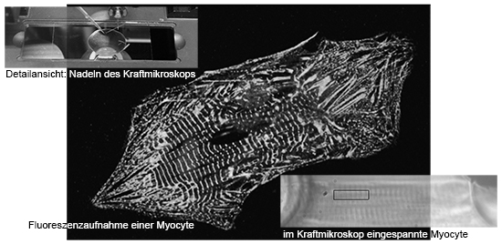 Darstellung der Kraftmessung einer einzelnen Myocyte